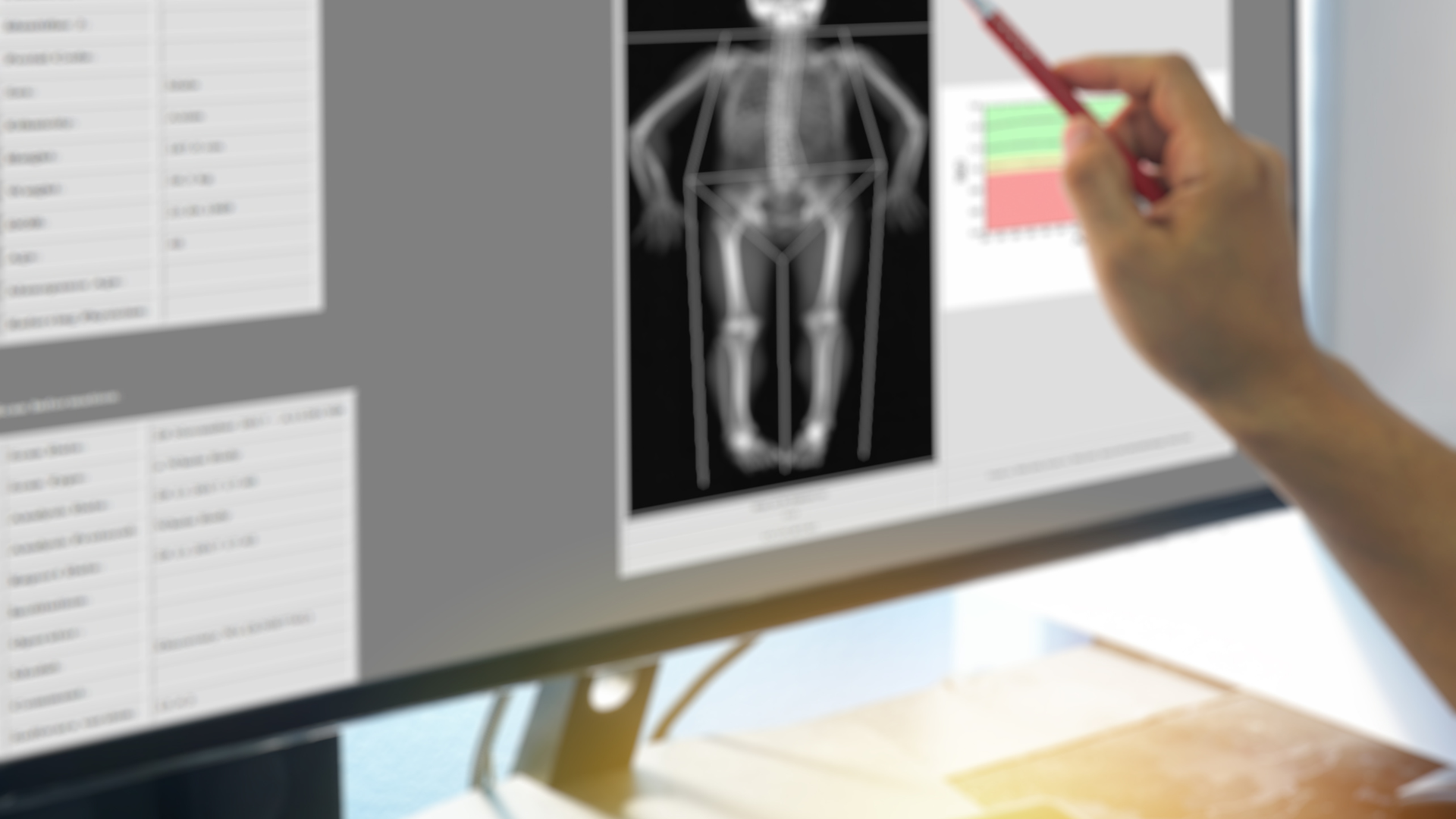 Densitometria ossea + Centro Medico Futura
